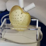 Cœur artificiel : l’offre de reprise de Carmat retenue par le TAE de Versailles