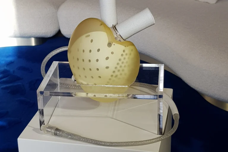 L'activité principale de Carmat est la fabrication de cœurs artificiels pour des patients en attente d'une transplantation cardiaque.