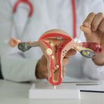 La France suspend la vente du dispositif FemBloc de stérilisation féminine