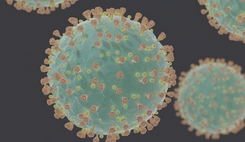 Coronavirus : adapter les charges à la baisse d’activité grâce au mandat ad hoc et à la conciliation